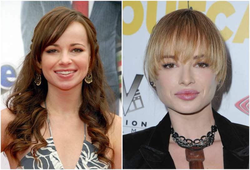 Ashley Rickards Lip Injections