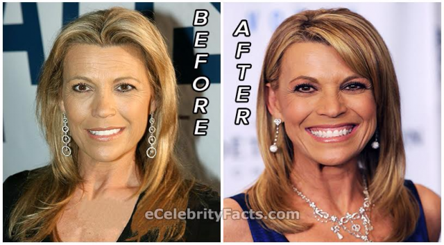 Vanna White Measurements Bra Size Height Weight