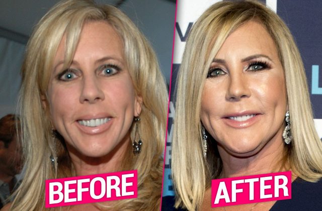 Vicki Gunvalson Measurements Bra Size Height Weight